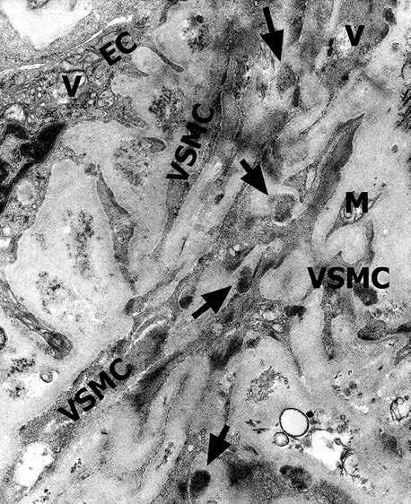 Semi-thin sections stained with toluidine blue were examined in the light microscope to select the areas required.