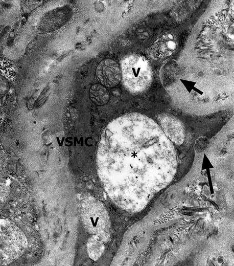 4B-C). The endothelial cells (EC) also revealed pathological changes. In their cytoplasm, narrow lumen and numerous vacuoles were seen (Fig. 5).