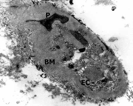 Eliza Lewandowska, Teresa Wierzba-Bobrowicz, Julia Buczek, Grażyna Gromadzka, Dorota Dziewulska A B C Fig. 7. Degenerative changes in capillary vessels of the skeletal muscle.