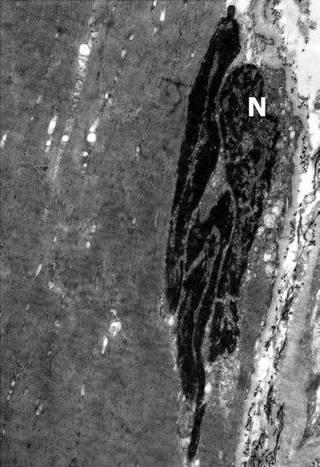 surrounding skeletal muscle fibres. Orig. mag. 7000.