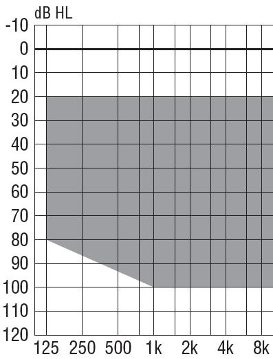 Aparat numer 6 Aparat cyfrowy, zauszny, technologia RIC (RITE) Zalecany zakres dopasowania (dopasowanie standardowe): Parametry według normy PN-EN 60118-0 Wartość średnia OSPL90 126 db SPL