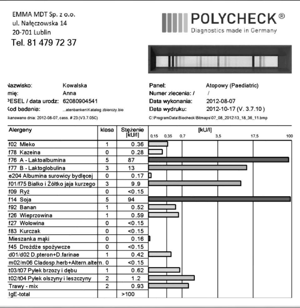 umieszczone zostały tam właśnie z myślą o najmłodszych dzieciach. Dlatego też wśród alergenów pokarmowych na tym teście, są takie które wprowadza się na początku do diety niemowląt.