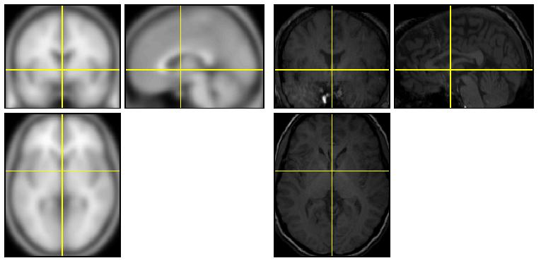 processing danych fmri: 2.