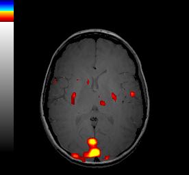 processing danych fmri: 3.