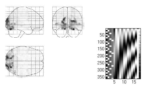 processing danych fmri: 4.