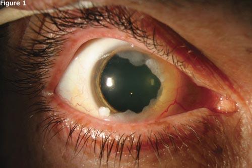 org http://www.aao.