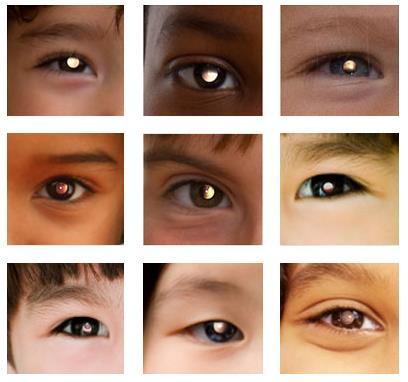 iscreen Vision Near-sightedness (Myopia) Far-sightedness (Hyperopia) Alignment
