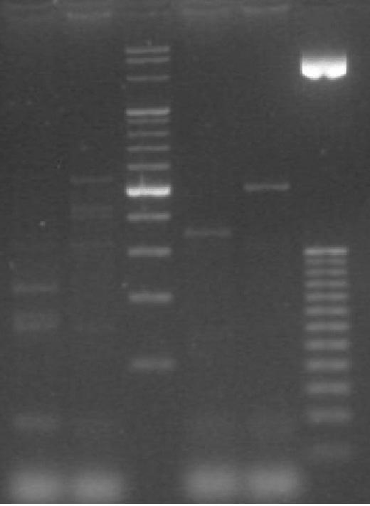 Analiza restrykcyjna produktu PCR (ścieżka 1 wzorzec 25 pz, ścieżka 2 BamH1, ścieżka 3 Dde1, ścieżka 4 wzorzec 50 pz, ścieżka 5 Kpn1, ścieżka 6 Tag1) Figure 1.