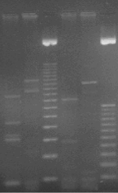Pneumonologia i Alergologia Polska 2007, tom 75, nr 2, strony 134 139 A B Rycina 3. Typ acetylacji INH zidentyfikowany metodą biologiczną i genetyczną u heterozygoty (NAT2*5/NAT2*6): A.