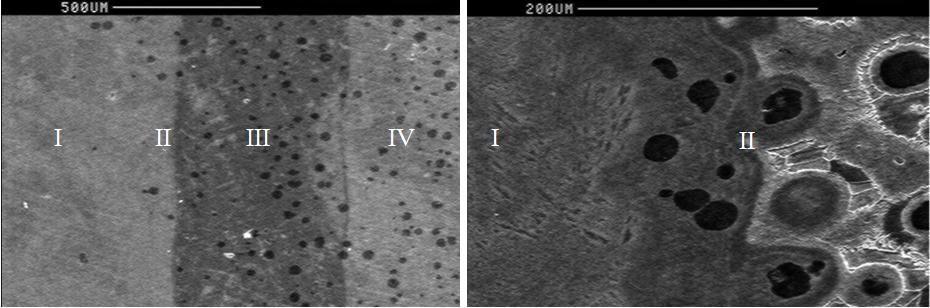 The analysis of the laser alloyed zone with boron in nodular iron... 335 Rys. 1.
