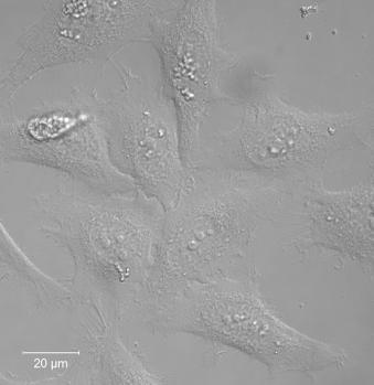 Posiadając wiedzę o fluorescencji, białkach fluorescencyjnych i mikroskopii konfokalnej możemy przystąpić do końcowej części eksperymentu obserwacji mikroskopowych.
