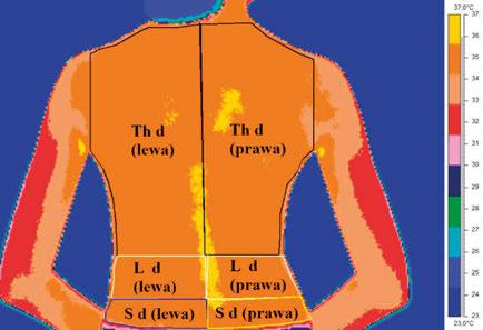 wydarzenia \ events streszczenia \ abstracts Abstract Diagnosis of curvature of the spine, in particular lateral curvatures, is still one of the more complicated tasks of orthopedics.
