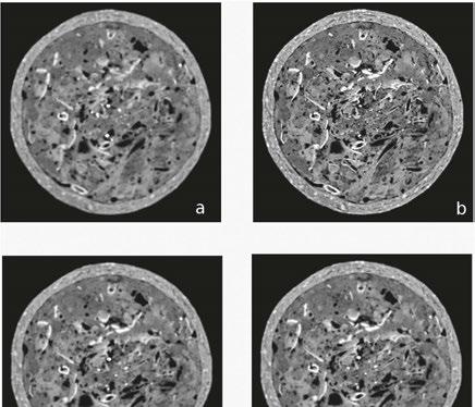 radiologia \ radiology artykuł naukowy \ scientific paper w obrazowanej przestrzeni.