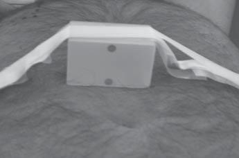 Positioning of the patient as well as their respiratory cycle are monitored on the x-ray simulator, equipped with the respiratory phase registration system.