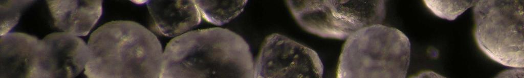 400 µm Rozkłady wielkości cząstek