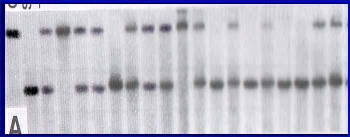 4. Markery DNA: enzymy restrykcyjne Cięcie genomowego DNA enzymami restrykcyjnymi jest podstawą metody RFLP: polimorfizmu długości fragmentów restrykcyjnych.