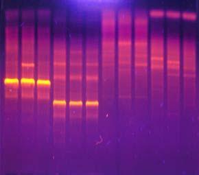 4. Markery DNA: PCR sekwencje unikalne Reakcja PCR pozwala powielić określony, unikalny fragment genomu pod warunkiem znajomości jego sekwencji. W reakcji PCR niezbędne są startery.