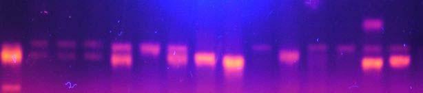 Allele różnią się długością, a więc także ruchliwością na żelu. U heterozygot widoczne są oba allele kodominacja. 4.