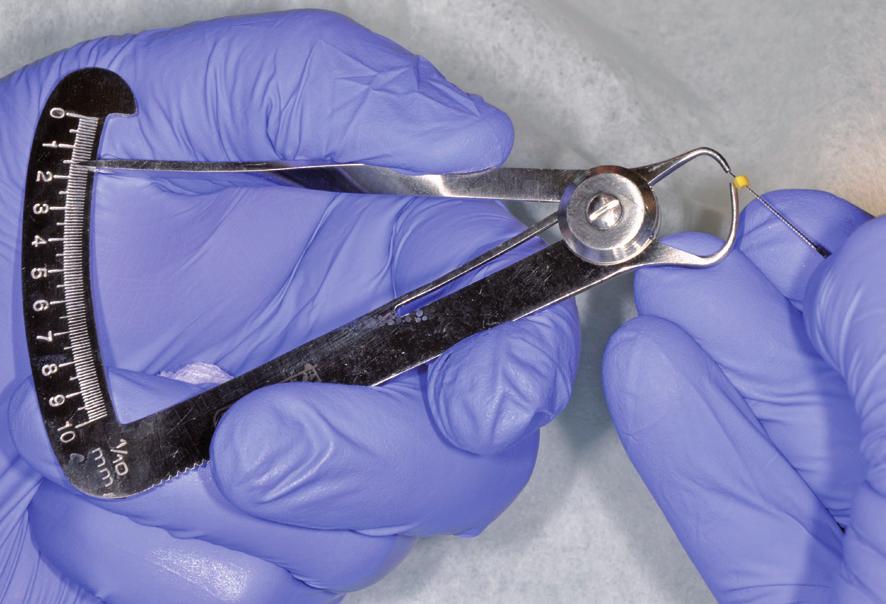 It is not a novel method [12, 13], but measurements of gingival thickness obtained with ultrasonic devices were till now very inaccurate in comparison with invasive methods, including an