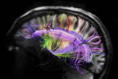 T cell Brain
