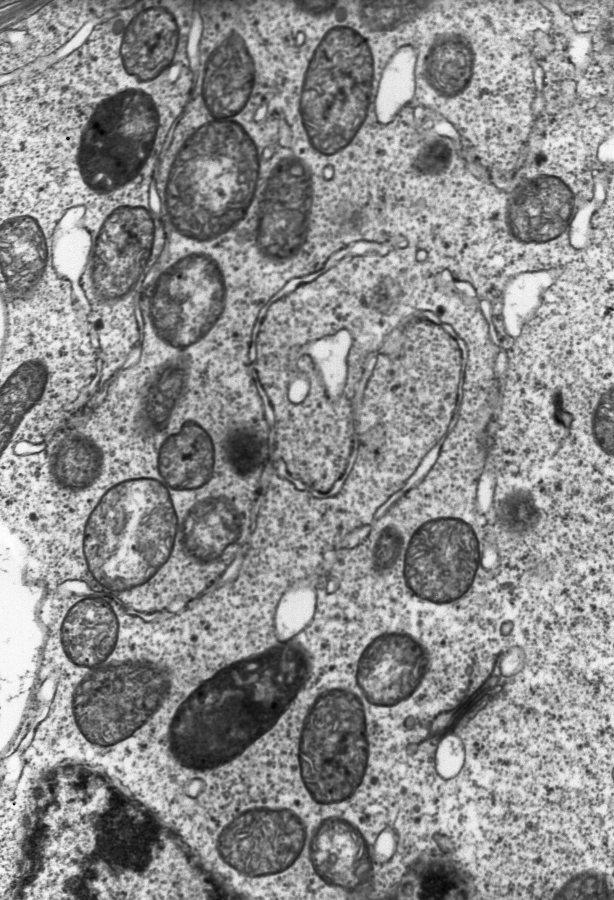 biotransformacji nie jest spowodowany