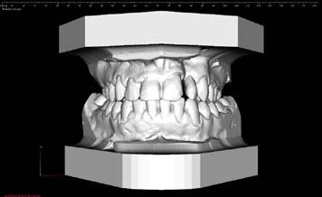 Badania kliniczne / Clinical research B. Racka-Pilszak et al. a b Rycina 1.