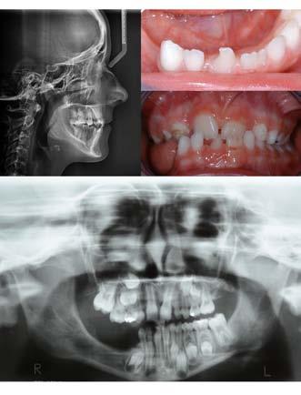 Opis przypadku / Case report M. Laskowska et al. Rycina 2.