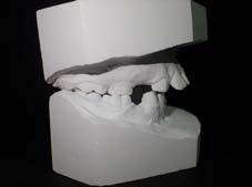 Solitary median maxillary central incisor case report Opis przypadku / Case report występowanie zaburzeń rozwojowych w obrębie układu sercowo-naczyniowego i nerwowego.