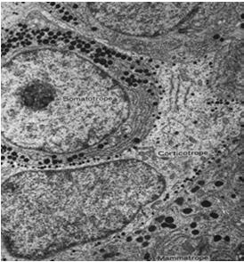 Golgiego, mniej siateczki szorstkiej (produkują hormony glikoproteidowe) Typ komórki Wielkość ziarn Produkowane hormony Somatotropy 300-400 nm GH