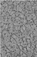 komórki pęcherzykowe (warstwy ziarnistej) komórki osłonki
