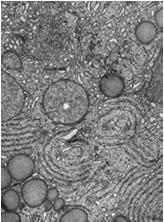 żółtego komórki osłonkowo-luteinowe ciałka żółtego komórki