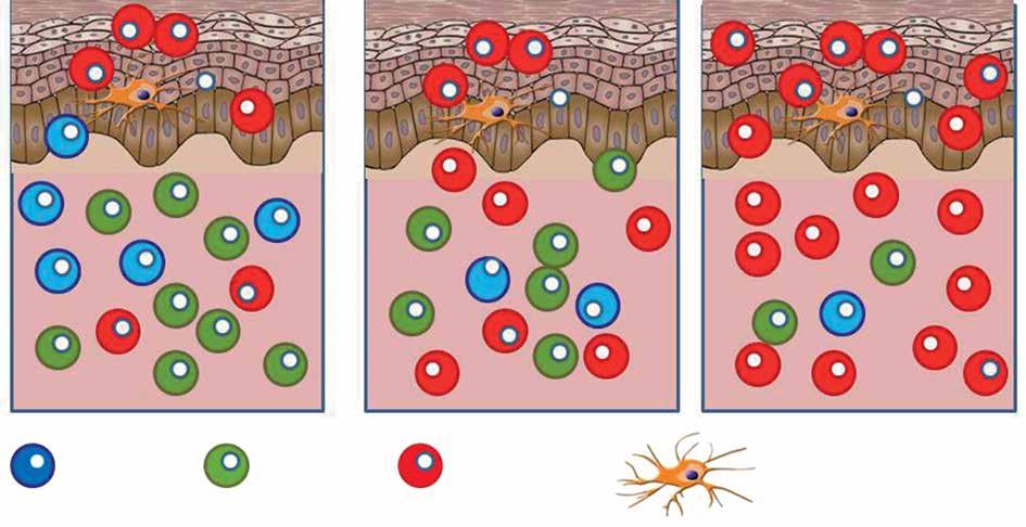 The role of regulatory T cells and genes involved in their differentiation in pathogenesis of selected inflammatory and neoplastic skin diseases.