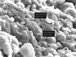 Al-Ti specimen, morphology in selected microregions, SEM image; 5000x Rys. 22. Próbka Al-Ti, morfologia w wybranych mikroobszarach, SEM; pow.