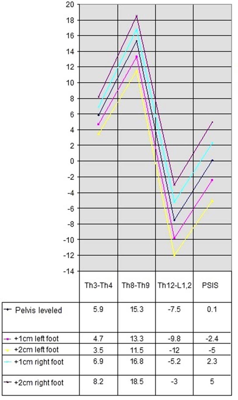 -3.0 3.0-2.5 2.5-3.5 3.0 0.0 0.0 +1cm left -1.1 ± 1.4-4.5 0.0-1.3 ± 1.6-5.0 2.0-1.4 ± 1.7-5.5 1.5-2.1 ± 1.1-4.0-0.5 +2cm left -1.8 ± 1.4-5.5-1.0-2.4 ± 1.7-6.5 1.5-3.2 ± 2.2-9.0 0.5-4.3 ± 1.7-7.5-1.5 +1cm right 0.