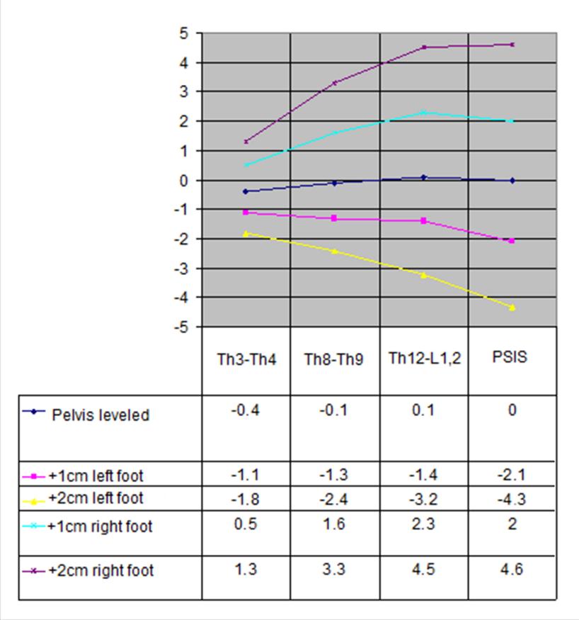 Figure 1. The difference of the angle of trunk rotation in patients with idiopathic scoliosis in a simulation of limb length discrepancy.