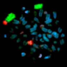 Rob 1,29 chromosom1 Chromosom 29 Translokacja 1,29
