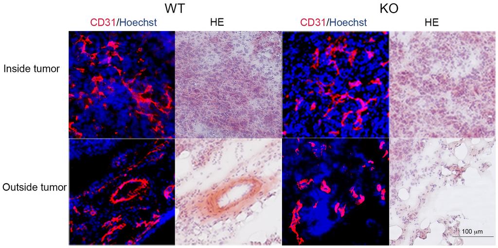 Supplementary Figure 9: Vascular plexa in the surrounding tissue and within the primary tumors.