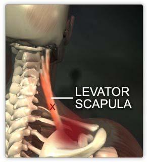or 4 ribs, inferior angle of scapula I: Intertubercular groove (just anterior to the pectoralis major insertion)