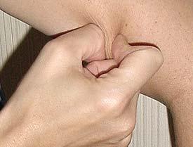 Pinch & React to Pain The examiner pinches the patient at the