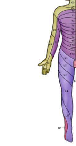 Neurologic Exam: Sensory Sensory dermatomes C2-C3: Occipital area and angle of jaw C4: Supraclavicular area Axillary Nerve Patch: Lateral aspect of shoulder C5: Lateral upper arm C6: Lateral forearm,