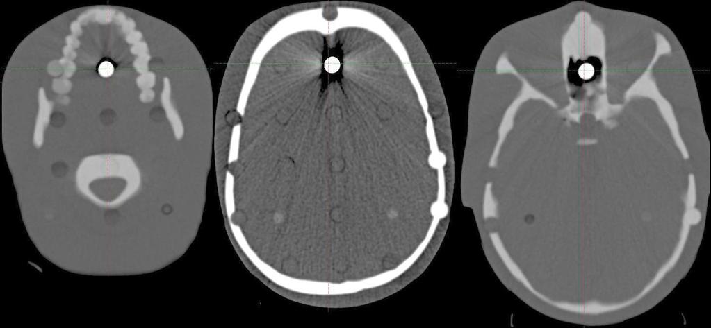 radiologia \ radiology artykuł naukowy \ scientific paper Wprowadzenie Do weryfikacji wybrano obszar głowy, ponieważ jest on jednym z najbardziej złożonych pod względem budowy, funkcji i sposobów