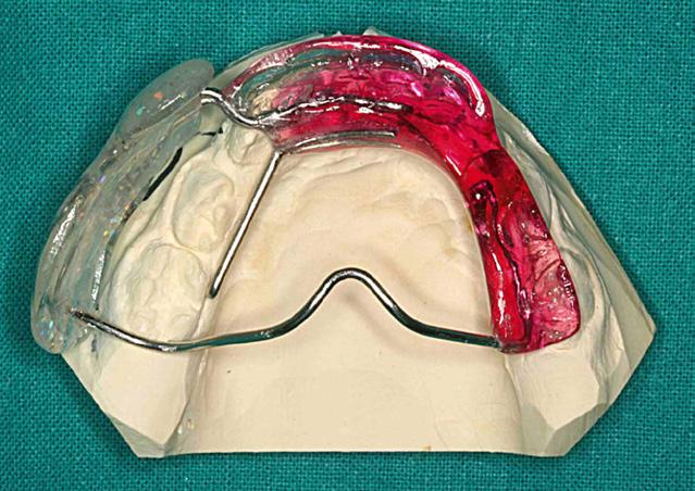 CLINICAL ORTHODONTICS 4/