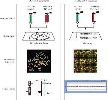 acgh- array Comparative Genomic Hybridization Porównawcza hybrydyzacja genomowa metoda pozwala na detekcję różnic w