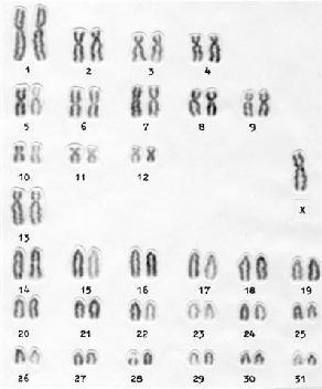 2n=46 (XX) Diagnozowana u 20% samoistnych poronień