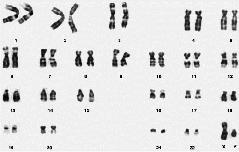 Duplikacja- zwielokrotnienie fragmentu chromosomu