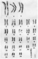 2,5-3,5 x10 12 Chromosomy