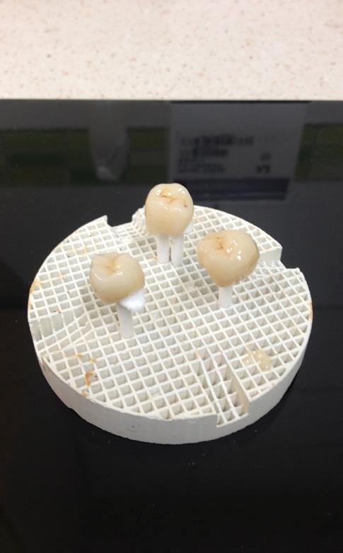 max CAD LT A1) skontrolowane pod względem poprawności morfologicznej i kolorystycznej na modelu gipsowym