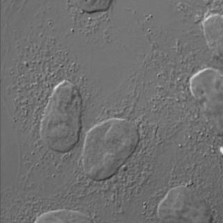 komórkowe (Hoechst) Białko X-EGFP