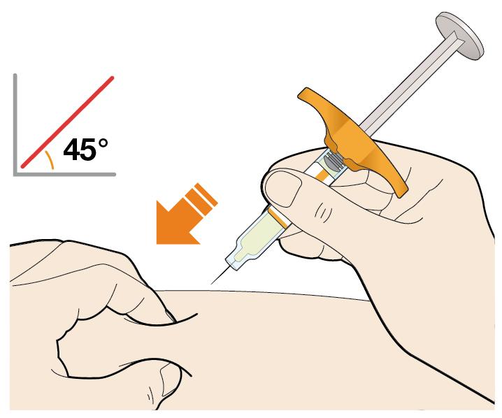wstrzyknięcia. 3. Wkłuć igłę w fałd skórny pod kątem około 45º. 4. Wcisnąć tłok.