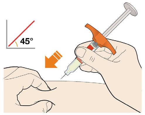 2. Uchwycić fałd skórny. Użyć kciuka i palca wskazującego do uchwycenia fałdu skórnego w miejscu wstrzyknięcia. 3. Wkłuć igłę w fałd skórny pod kątem około 45º. 4. Wcisnąć tłok.